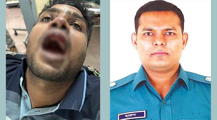 ছাত্রলীগের কেন্দ্রীয় নেতাকে পিটিয়ে দাঁত ফেলে দেয়ার অভিযোগ 
