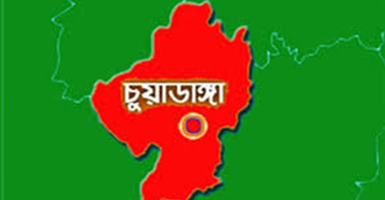 শ্বাসনালীতে দুধ আটকে শিশুর মৃ ত্যু