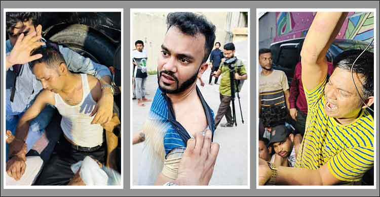 শিল্পী সমিতির শপথ শেষে এফডিসিতে মারামারি, সাংবাদিকসহ আহত ১০