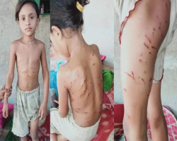 কোম্পানীগঞ্জে বেওয়ারিশ কুকুরের উপদ্রবে অতিষ্ঠ এলাকাবাসী