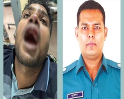ছাত্রলীগের কেন্দ্রীয় নেতাকে পিটিয়ে দাঁত ফেলে দেয়ার অভিযোগ 