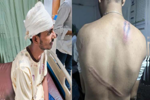 সিলেটে জুলাই স্মৃতি ফুটবল টুর্নামেন্টে হা*মলায় আ হ ত ১৪