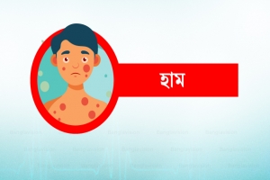 সিলেটে ২৪ ঘণ্টায় দুই শিশুর মৃ'ত্যু, হাসপাতালে ১৫৮ জন সিলেটে ২৪ ঘণ্টায় দুই শিশুর মৃ'ত্যু, হাসপাতালে ১৫৮ জন